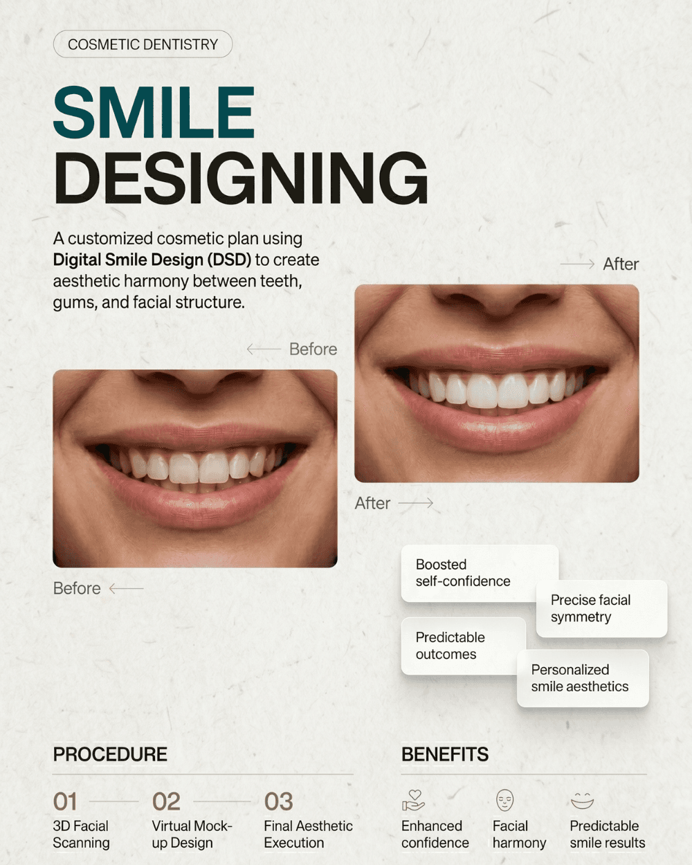 Smile Designing