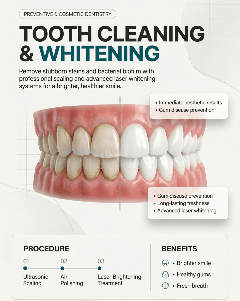 Tooth Cleaning & Whitening
