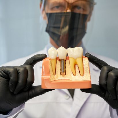 serious-dentist-showing-a-teeth-model-with-implant-2023-11-27-05-25-19-utc.jpg